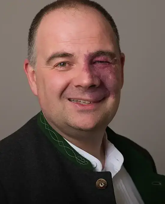 Markus Kennerknecht - 1. Bürgermeister